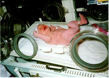 Jessika warming up in an Incubator.